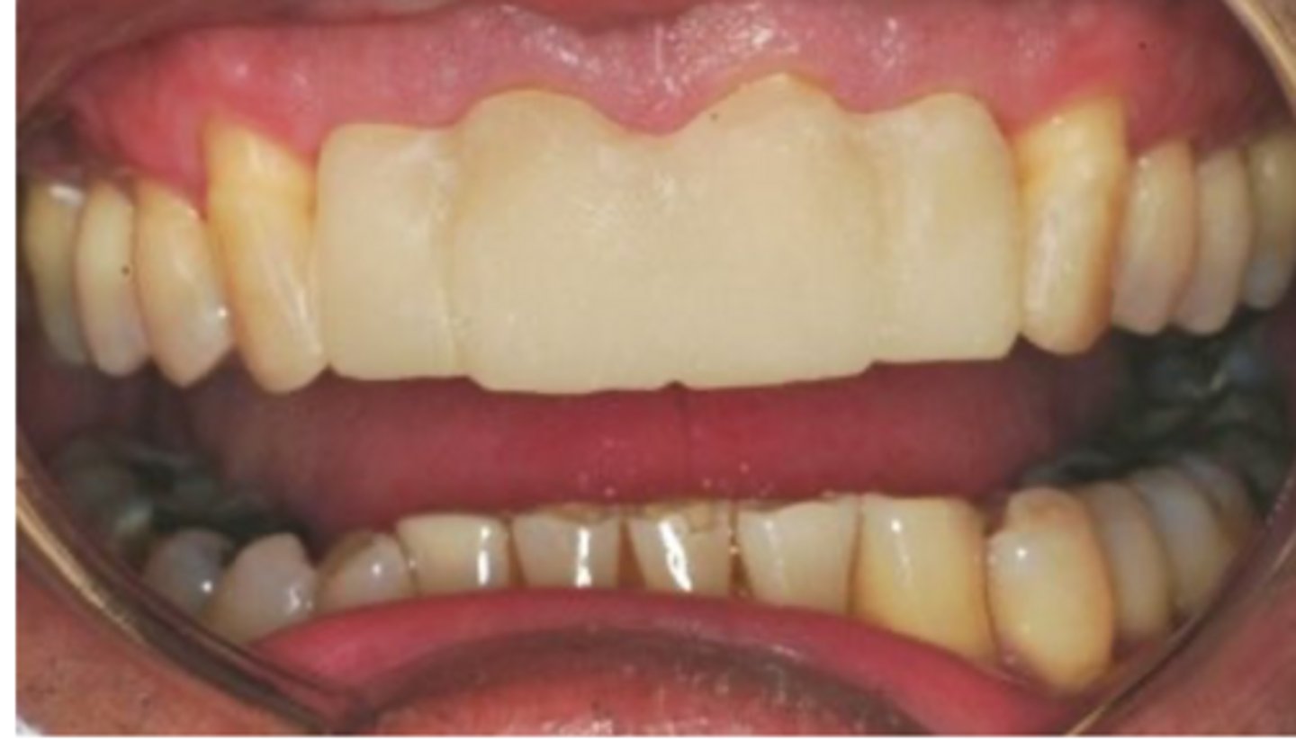 <p>What is wrong with this crown?</p>