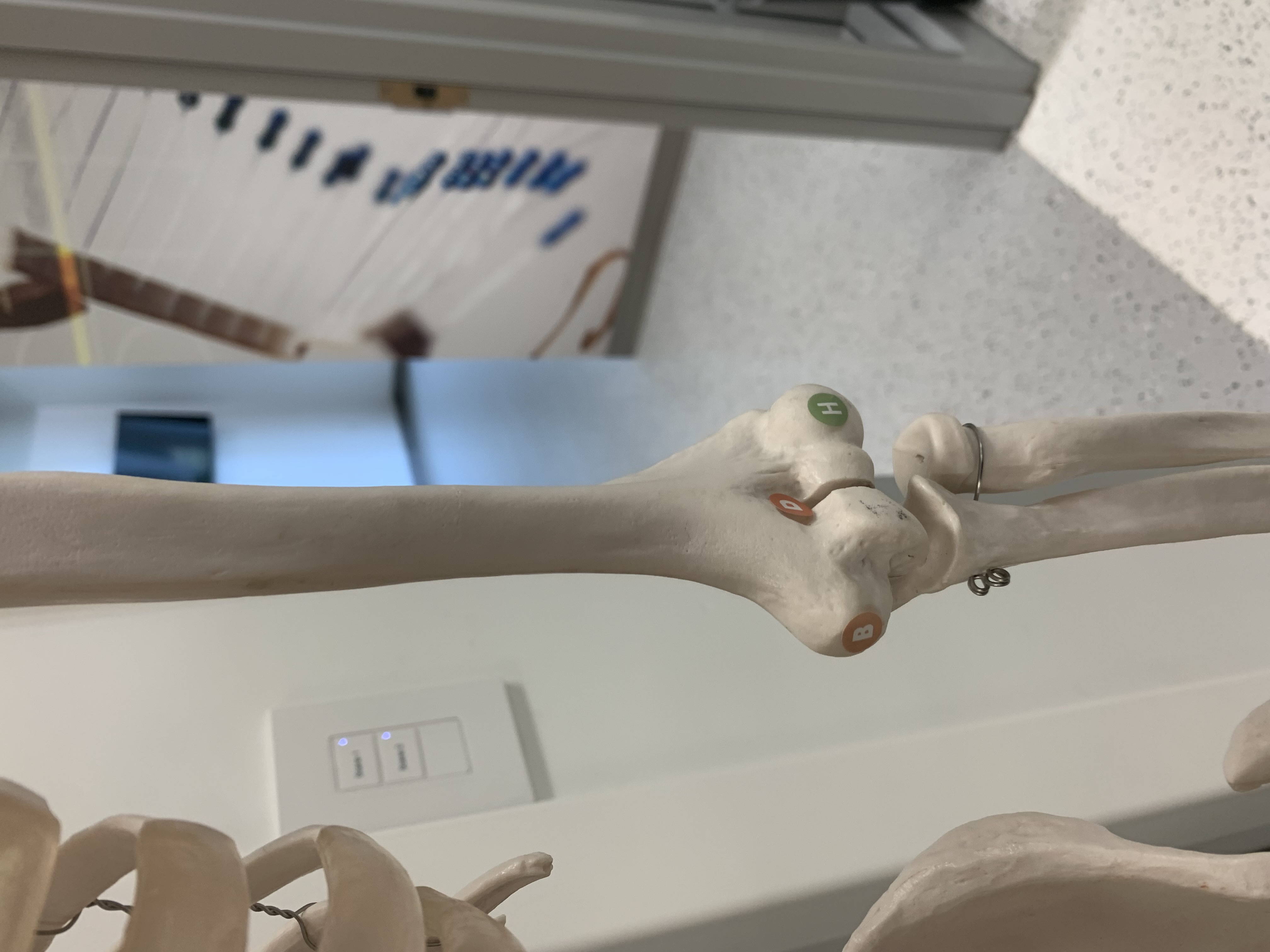 <p>Medial Epicondyle</p>