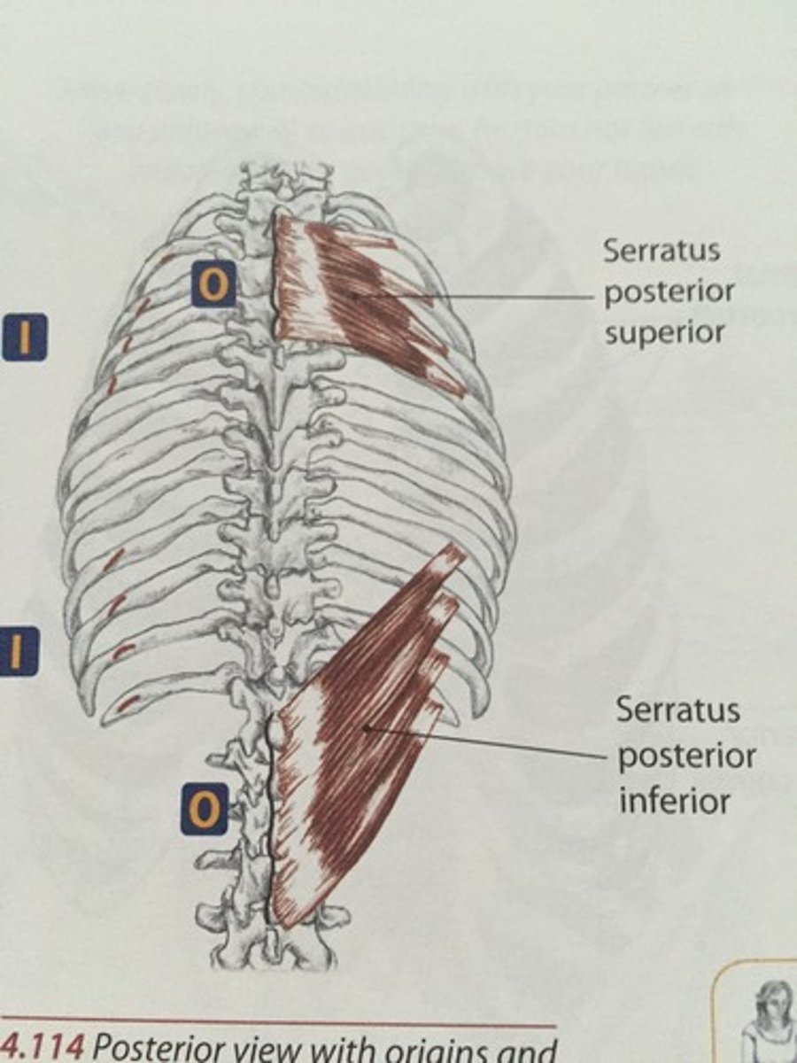 <p>Proximal Attachment/ Origin:</p><p>-spinous process of T11-L2 vertebrae</p><p>Distal Attachment/ Insertion:</p><p>-inferior border of ribs 9-12</p><p>Innervation:</p><p>-intercostal nerves T9-T12</p><p>Action:</p><p>-depress ribs</p>