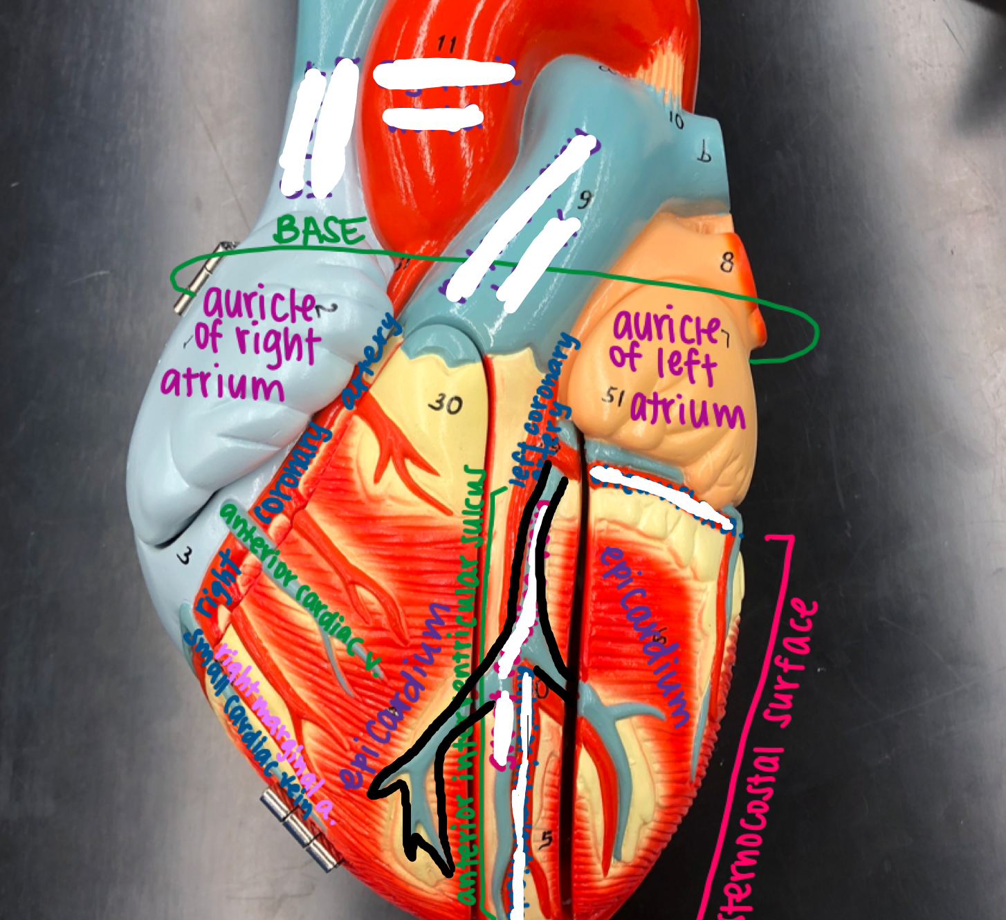 <p>The middle blue vein that splits into 2 on the front of the heart</p>