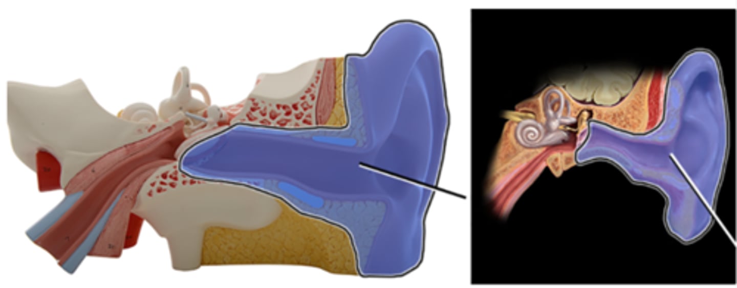 <p>Which structure is highlighted and indicated by the leader line?</p><p>a. Inner ear</p><p>b. External ear</p><p>c. Middle ear</p><p>d. Cochlear</p><p>e. Occipital bone</p>
