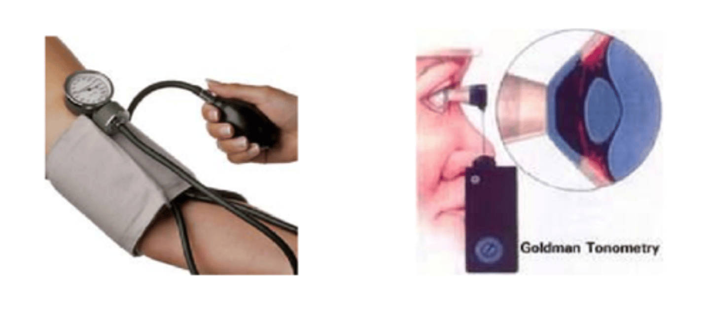 <p>numeric variable that can technically be measured with unlimited precision with NO gaps in values that the variable could assume</p><p>ex) BP, IOP</p>