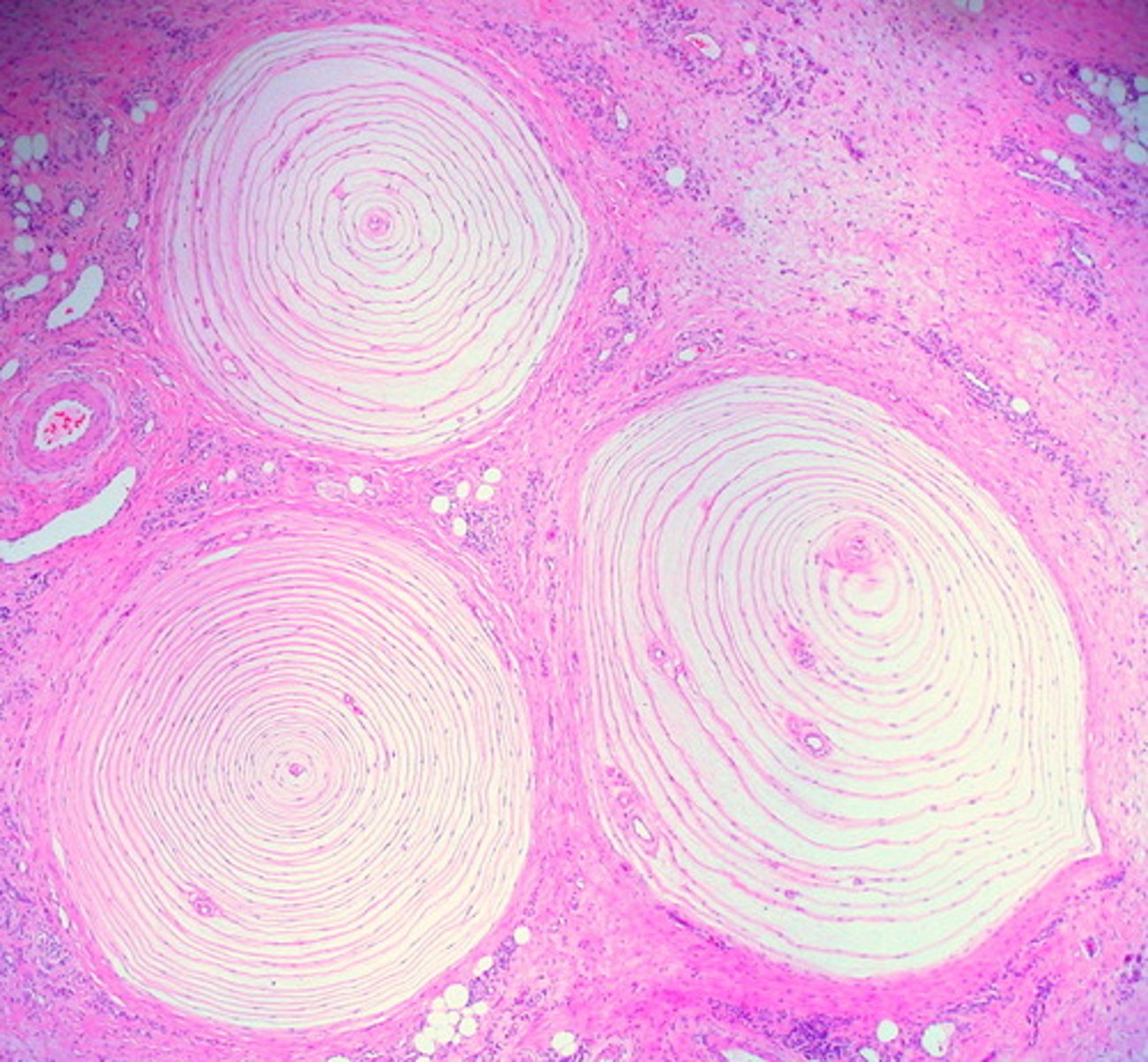 <p>deep pressure receptors, look like onions</p>