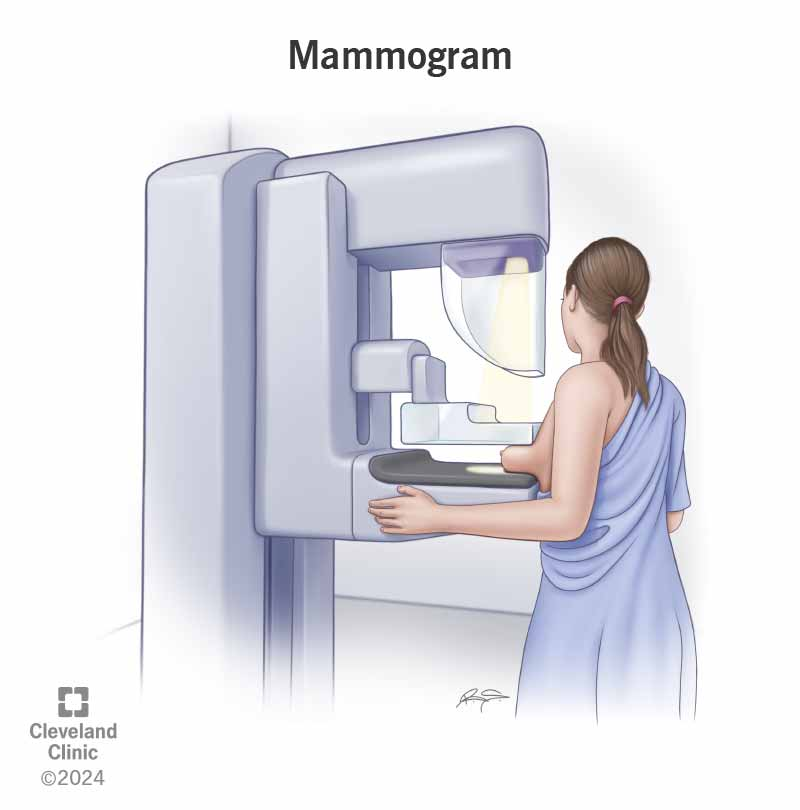 <p><strong>Mammograms @ age 40!!</strong></p><ul><li><p>clinical breast exams <span style="color: rgb(218, 59, 59);"><strong><span>q3 years (20-39)</span></strong></span></p><ul><li><p>the dr palpates breasts</p></li></ul></li><li><p>annually when<span style="color: rgb(203, 48, 182);"><strong><span> >40 years!!</span></strong></span></p></li></ul><p></p>