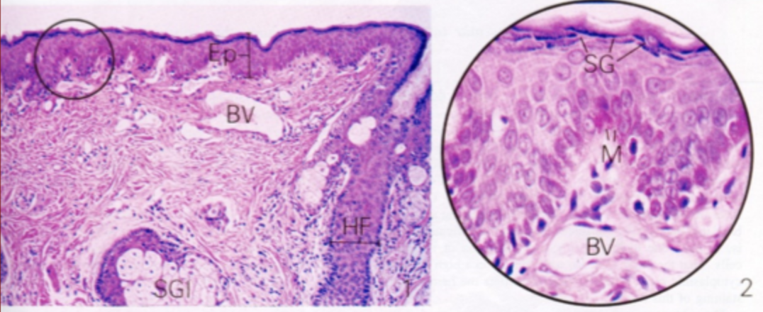 <p>Cara externa del labio</p>