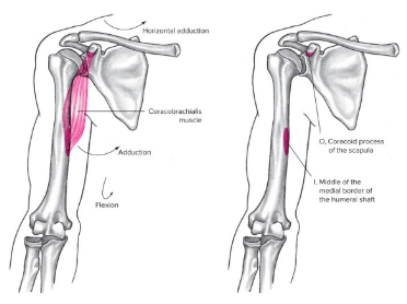 <ul><li><p><strong><u><span style="font-family: Arial, sans-serif">Origin</span></u></strong><span style="font-family: Arial, sans-serif">: coracoid process</span></p></li><li><p><strong><u><span style="font-family: Arial, sans-serif">Insertion</span></u></strong><span style="font-family: Arial, sans-serif">:&nbsp; medial border of humerus shaft</span></p></li><li><p><strong><u><span style="font-family: Arial, sans-serif">Action(s)</span></u></strong><span style="font-family: Arial, sans-serif">:&nbsp;</span></p><ul><li><p><span style="font-family: Arial, sans-serif">flexion,&nbsp;</span></p></li><li><p><span style="font-family: Arial, sans-serif">ADduction</span></p></li><li><p><span style="font-family: Arial, sans-serif">horizontal ADduction</span></p></li></ul></li></ul><p><strong><u><span style="font-family: Arial, sans-serif">Antagonist</span></u></strong><span style="font-family: Arial, sans-serif">: latissimus muscle, infraspinatus*</span></p>