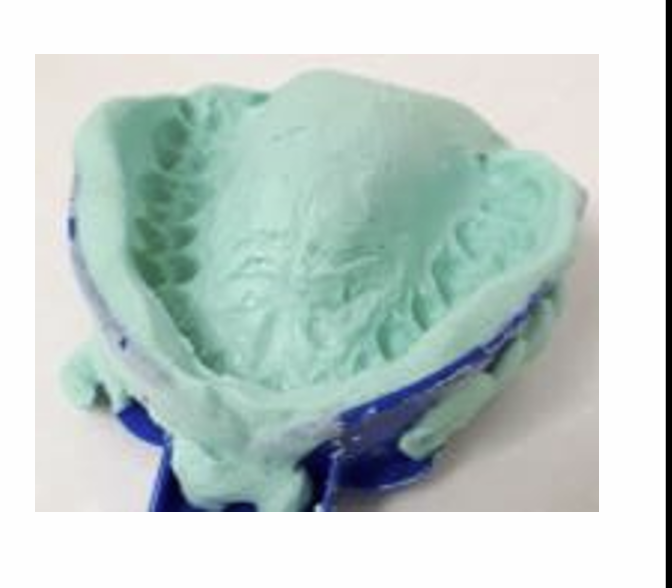 <p>What is the problem with this impression?</p>