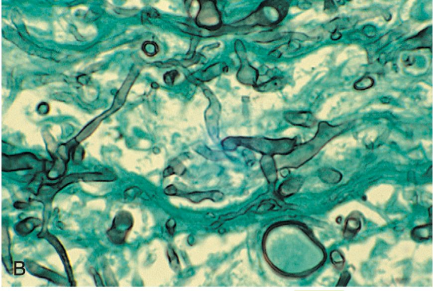 <p>A genus of fungi belonging to the order Mucorales.</p>