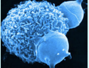<p><strong>A type of white blood cell that surrounds and kills microorganisms, removes dead cells, and stimulates the action of other immune system cells</strong></p>