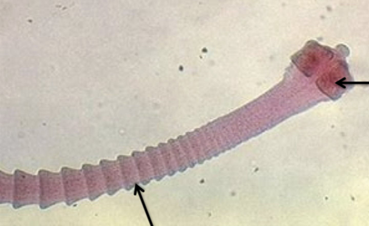 <p>parasite</p><p>scolex (face)</p><p>proglottid</p>