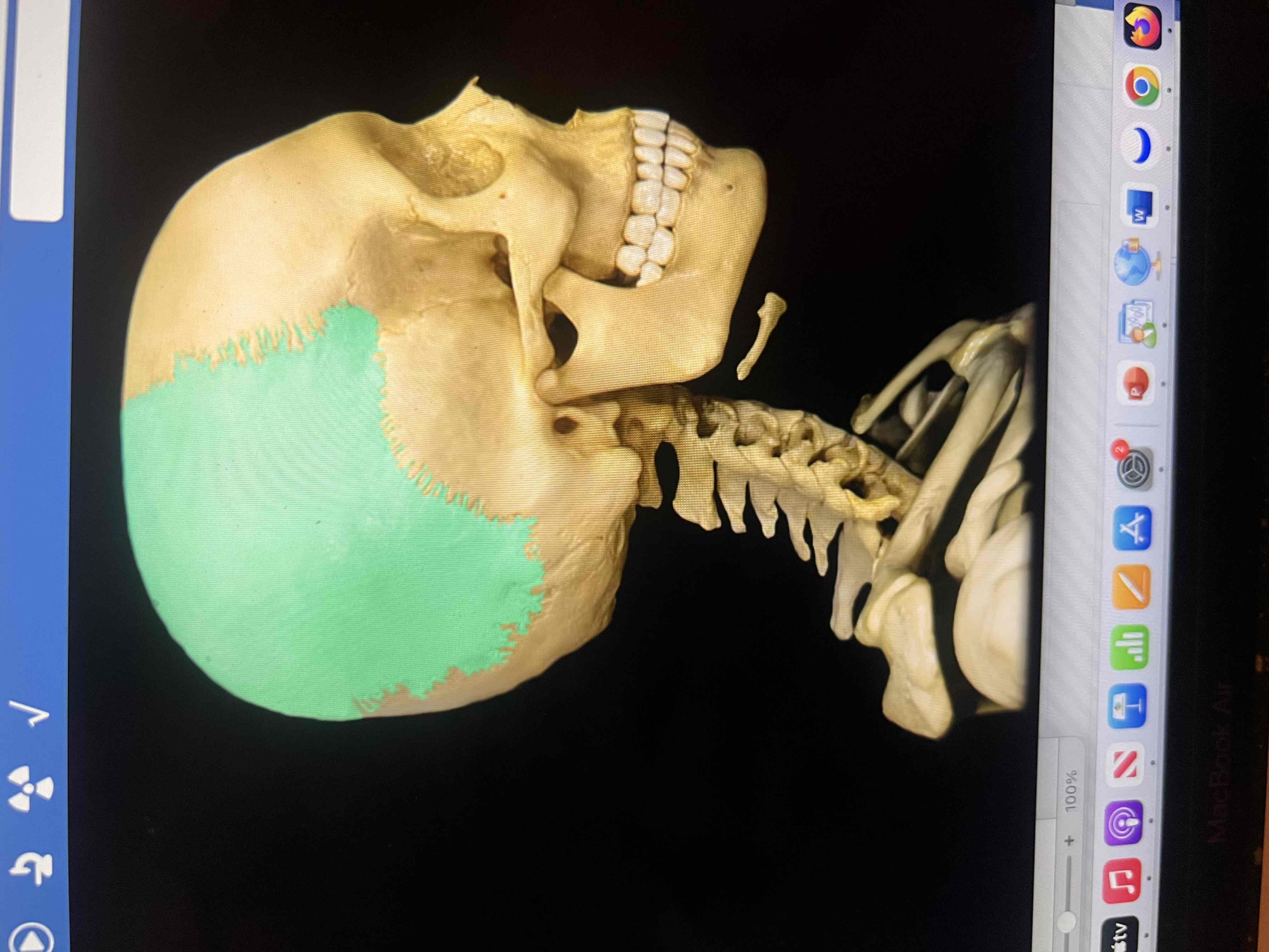 Skull bones and markings Flashcards Knowt