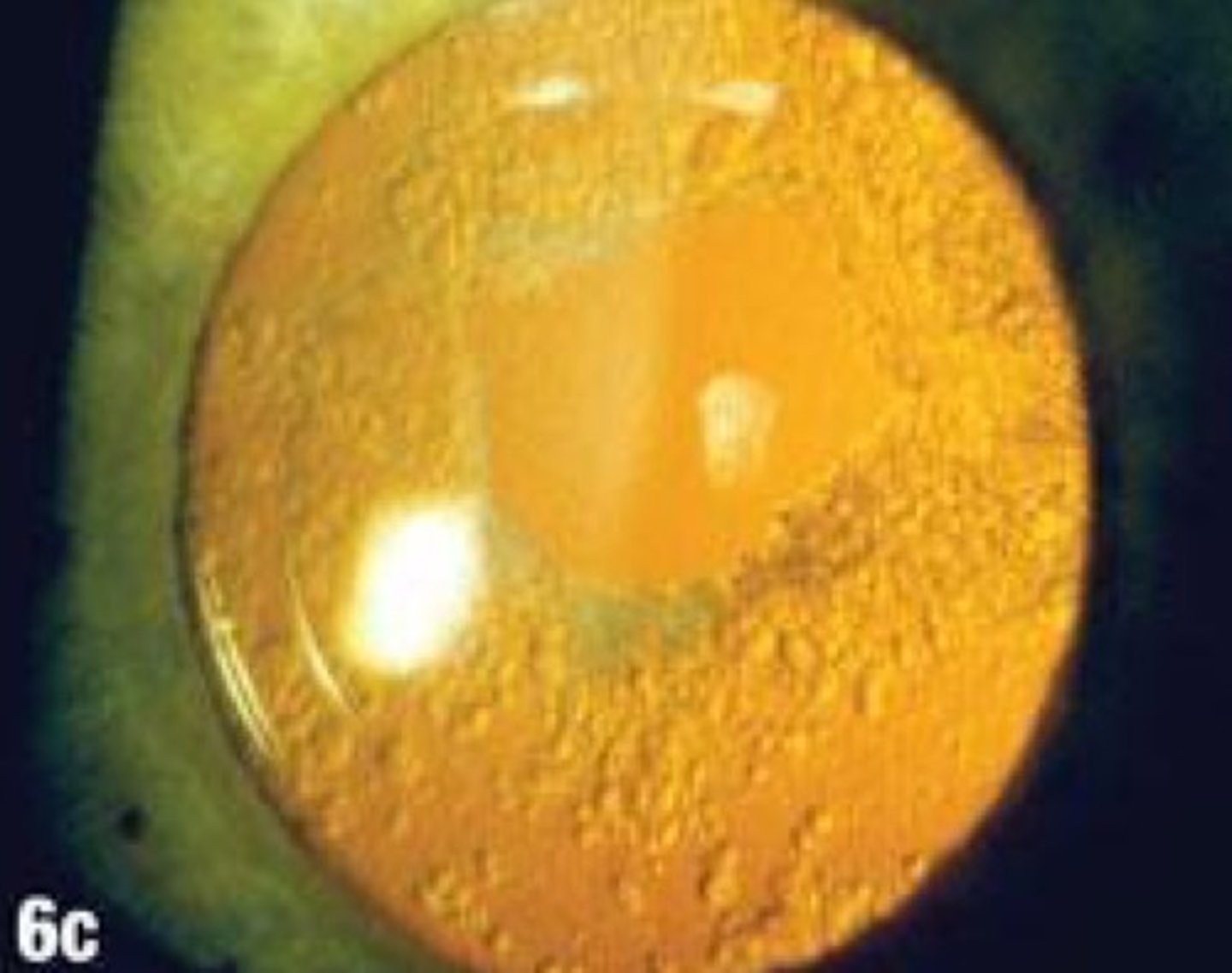 <p>Laser</p>