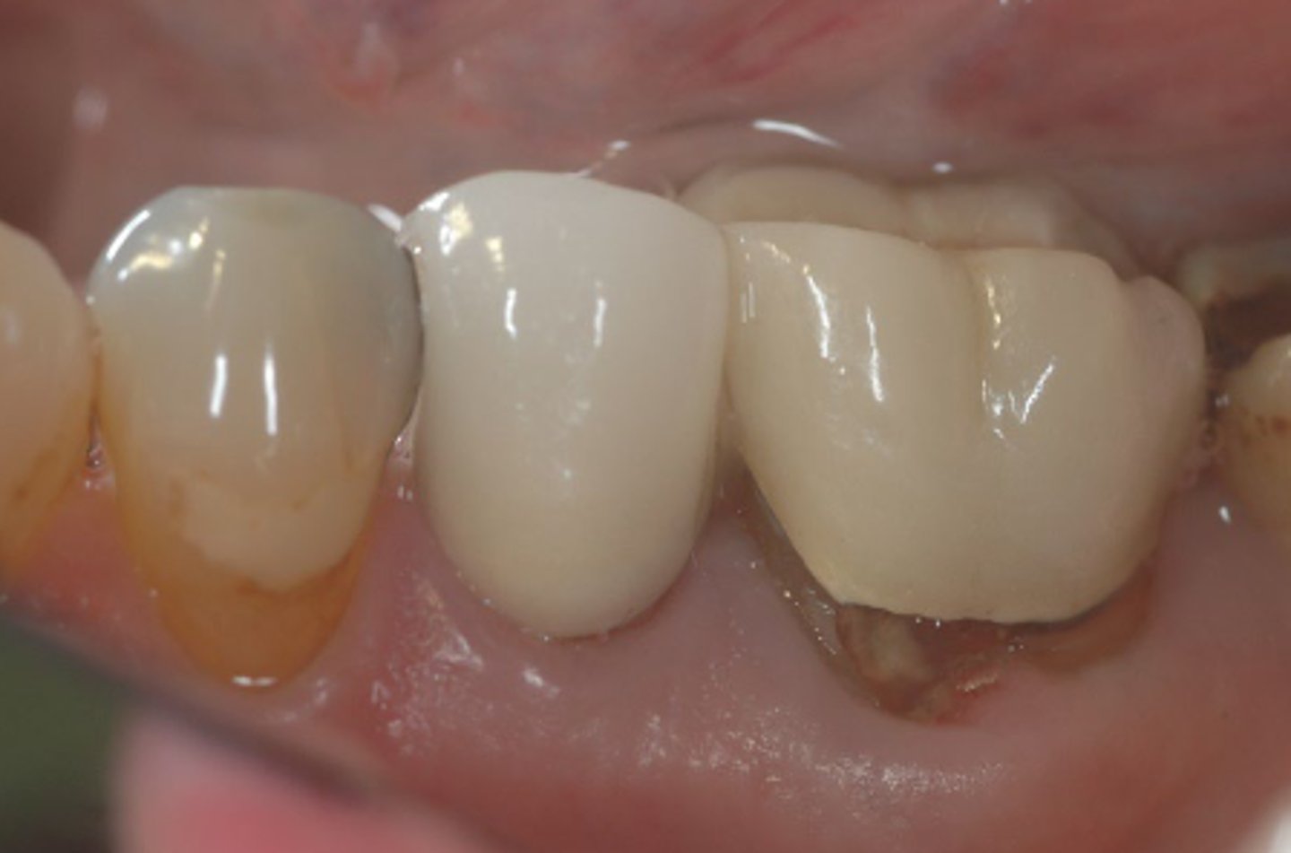 <p>What caused this defect?</p>