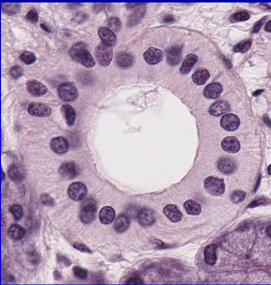 <p><strong>–Striated ducts</strong></p><p>•Columnar epithelium</p><p>•Basal membrane infoldings</p><p>•Mitochondria</p><p>•Ion transport</p><p>•Hypotonic saliva</p><p>•Centrally-placed nucleus</p>