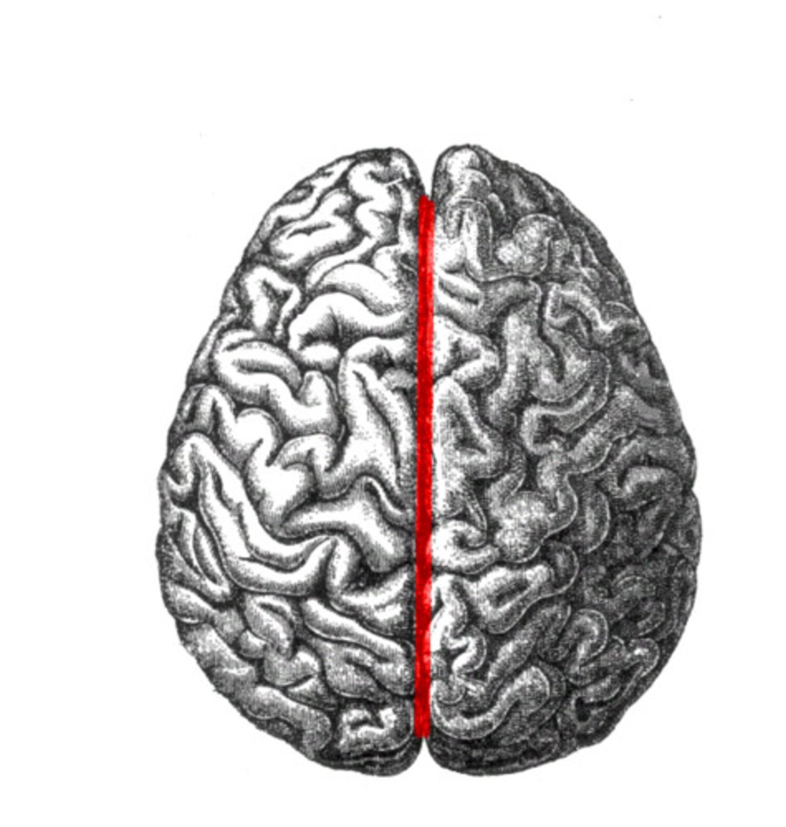 <p>separation of cerebral hemispheres</p>