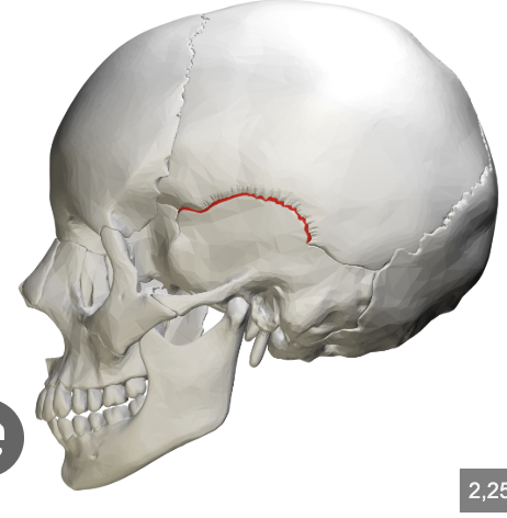<p>what suture is this </p>