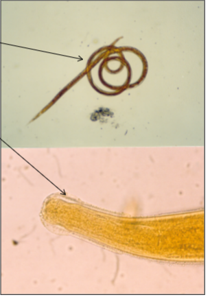 <p>cattle and sheep&nbsp;</p><p>spring / coiled, has a cephalic vesicle, short spicules on male.&nbsp;</p><p>gerenrally mild. </p><p>when heavy causes catarrhal enteriti, atrophy and oedema of intestinal mucosa. </p>