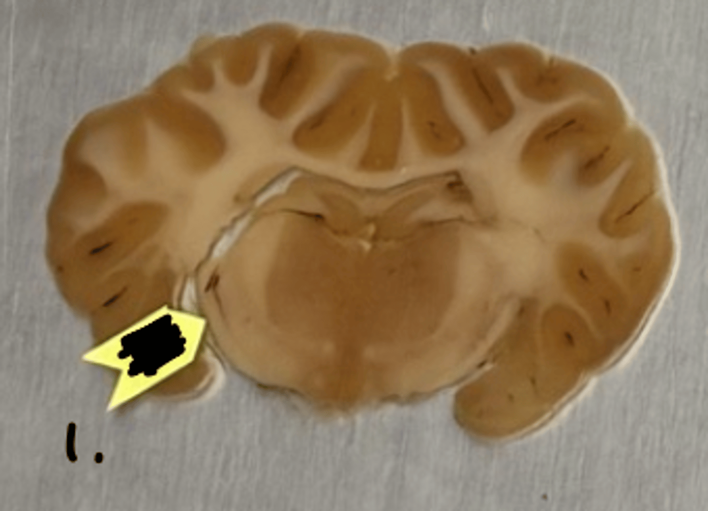 <p>what structure is labeled as #1 ?</p>