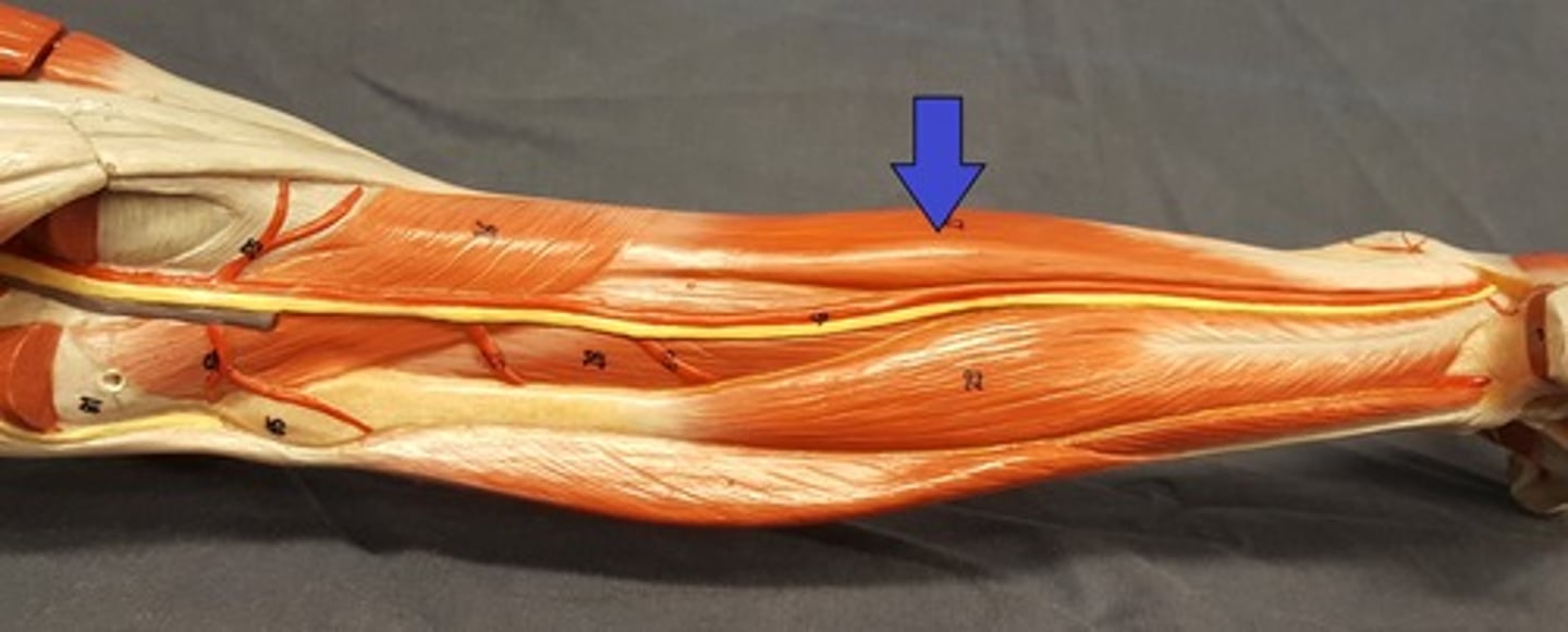 <p>Seen after removing the gastrocnemius on the medial side along the tibia.</p>