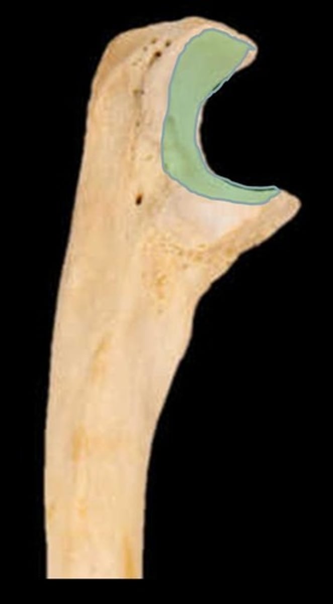 <p>ID part of bone shown in blue</p>