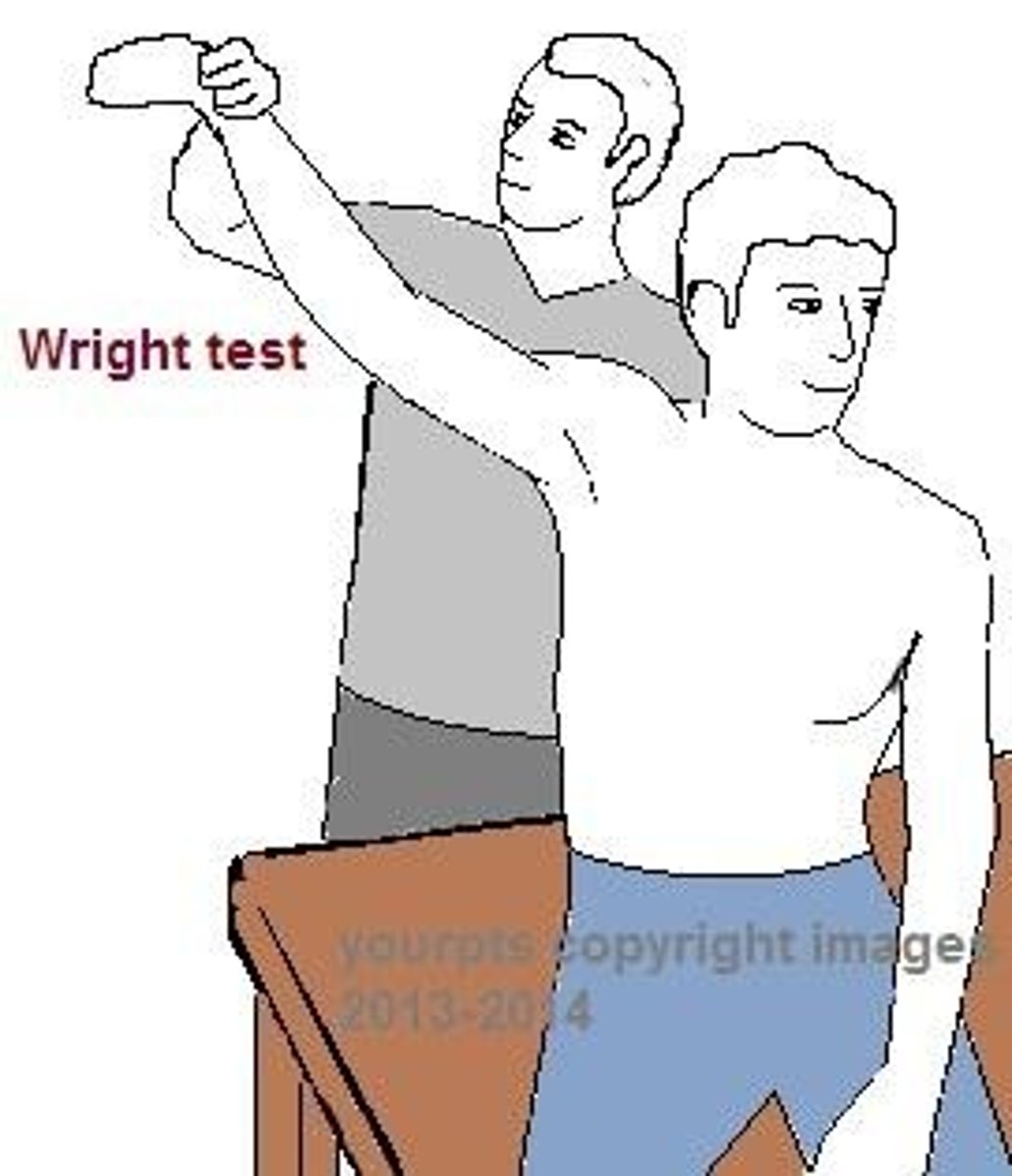 <p>Thoracic outlet syndrome</p><p>-pt sitting</p><p>-PT finds radial pulse and move shoulder into max abduction and ER; instruct patient to rotate head award from extremity being tested</p><p>-neuro/vascular symptoms reproduced in UE</p>