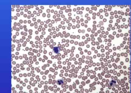 <p>Identify the types of blood cells</p>