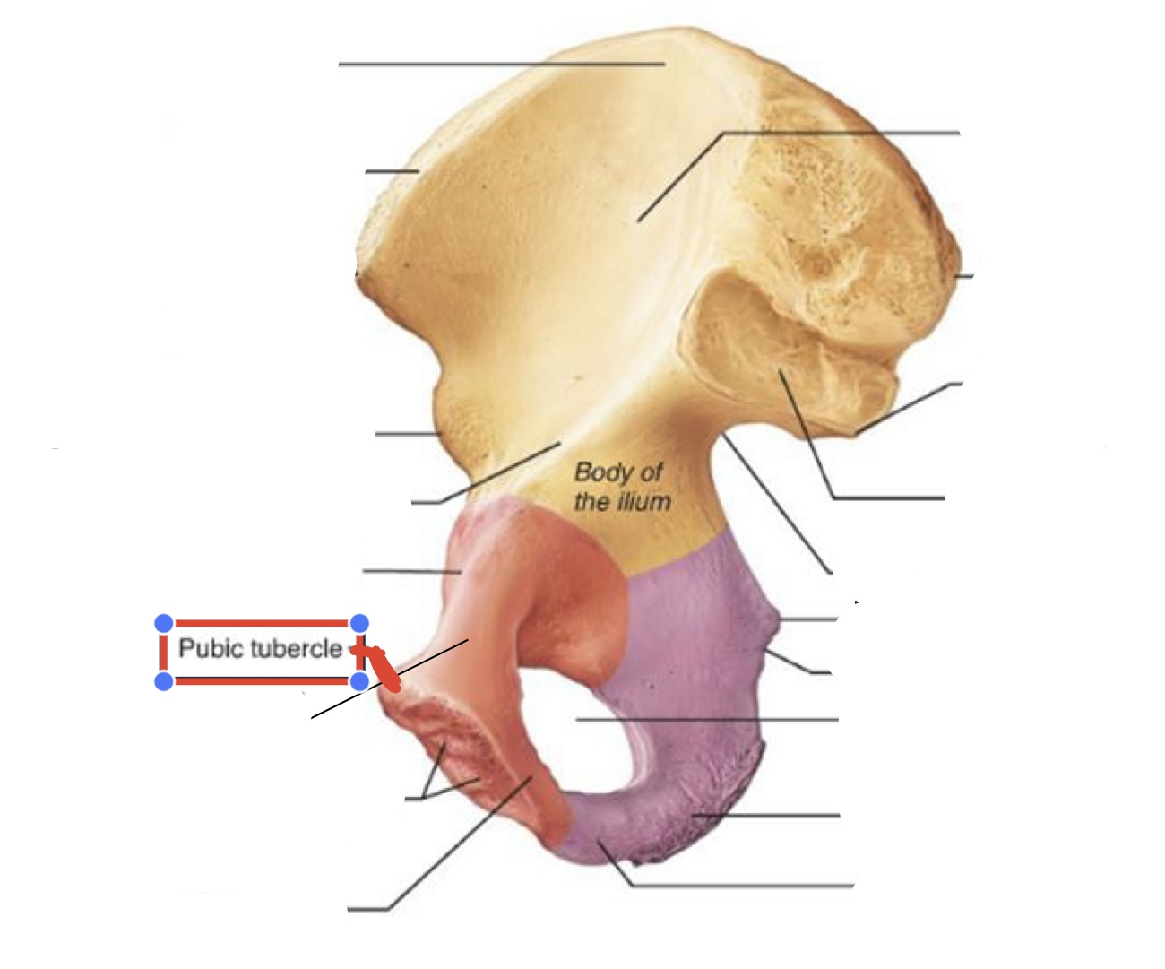 <p><span><span>Pubic tubercle</span></span></p>