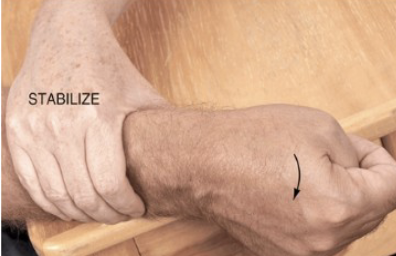 <p>Tendon/ Muscle Pathology: <strong>Finklestein (Eichhoff)</strong></p>