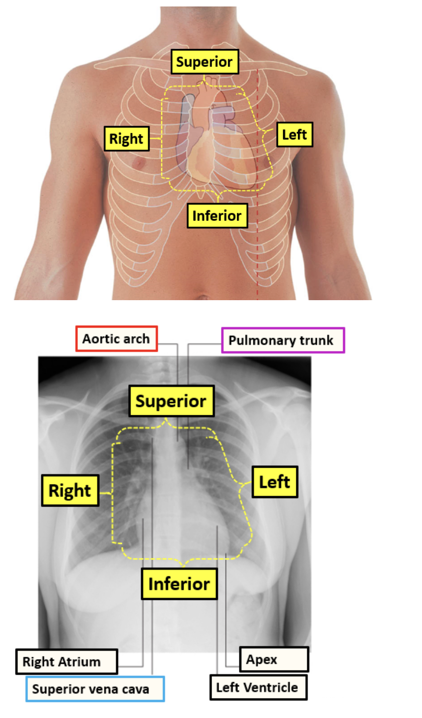 <p>visible in both posterior and anterior views</p><ol><li><p>right</p></li><li><p>superior</p></li><li><p>left</p></li><li><p>inferior</p></li></ol><p></p>