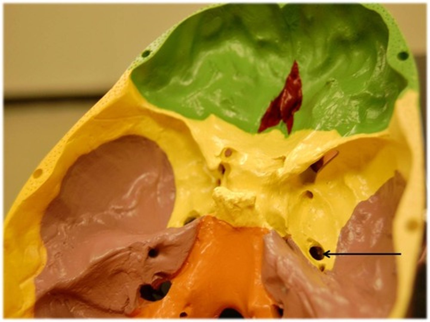 <p>Name this foramen.</p>