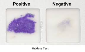 <p>What test does this indicate?</p>