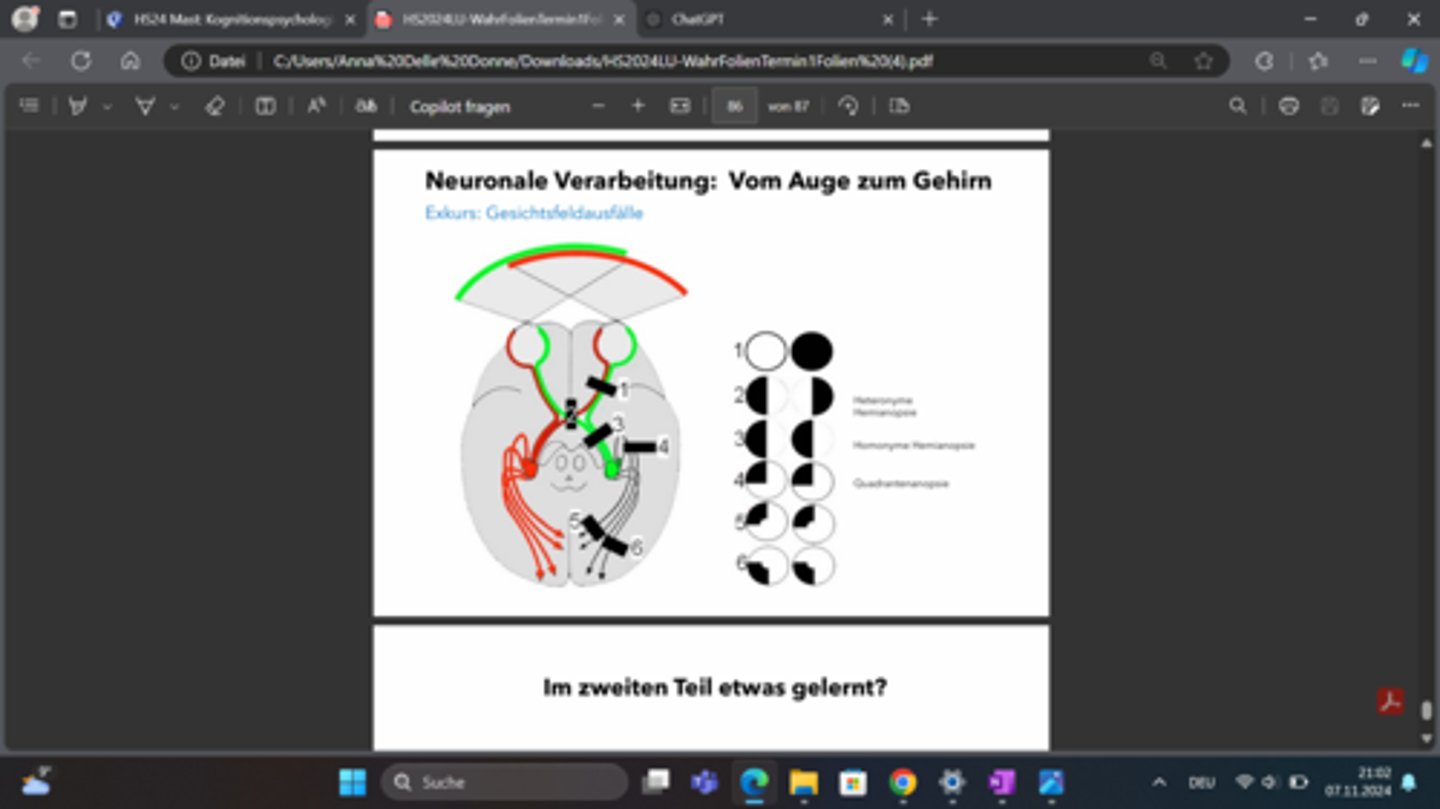<p>1) Sehnerv affected</p><p>2) Sehnervkreuzung affected</p><p>3)Sehnerv affected</p><p>4)?</p><p>5)</p><p>6)</p>