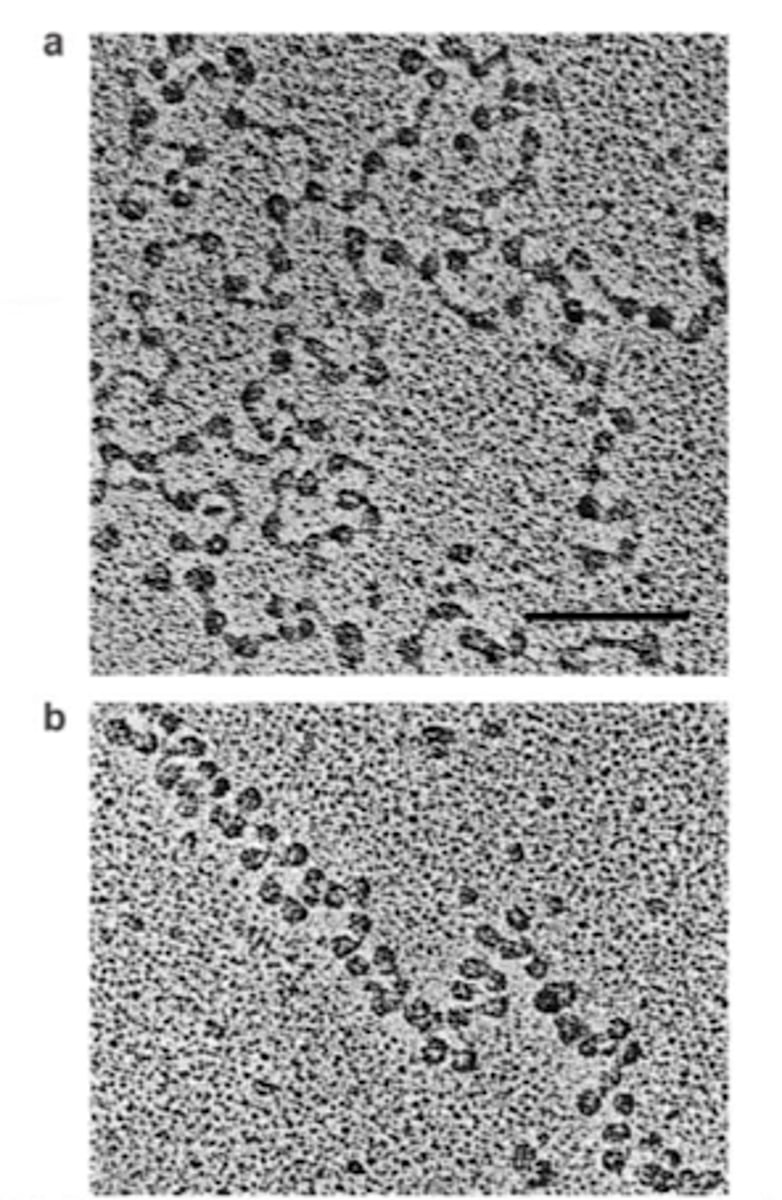<p>Adding ___________ induces compaction of DNA into the solenoid structure.</p>