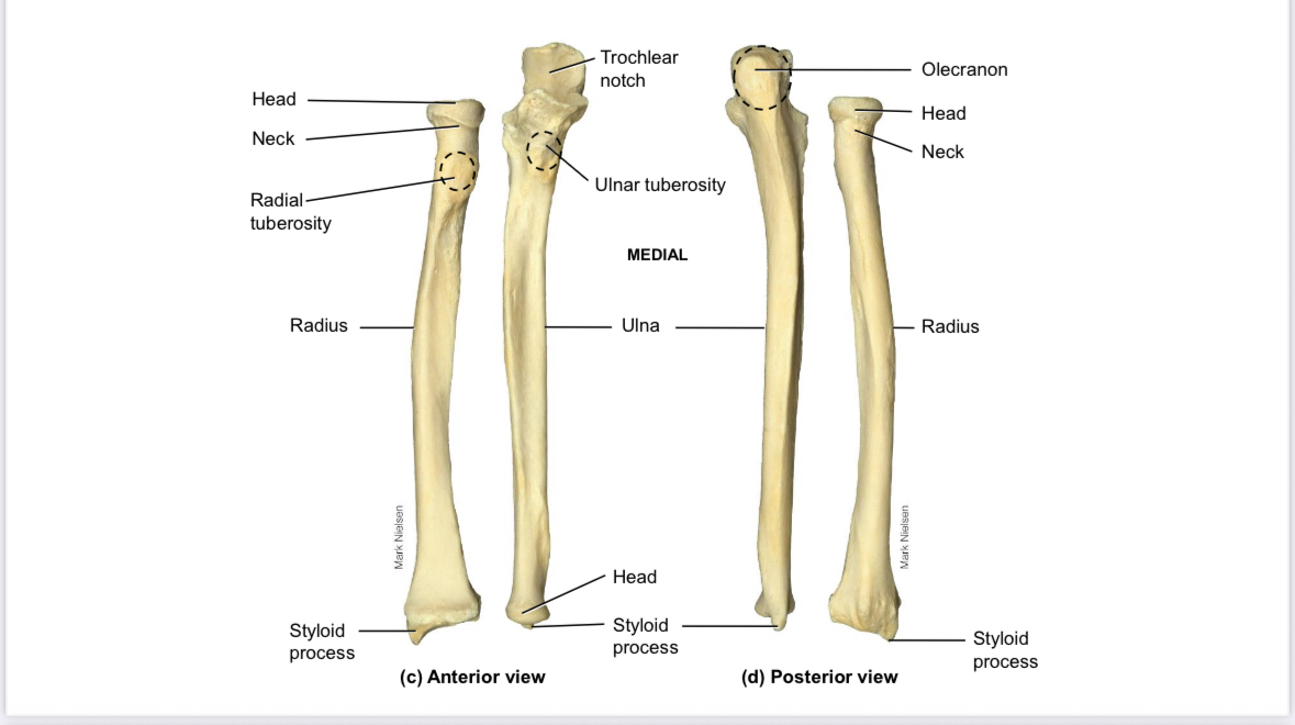 <p>Ulna: head of ulna</p>