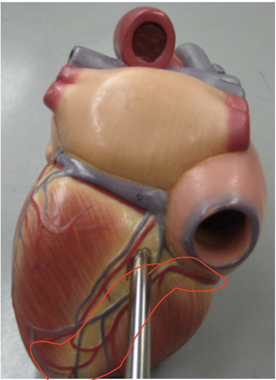 <p>right coronary artery</p>