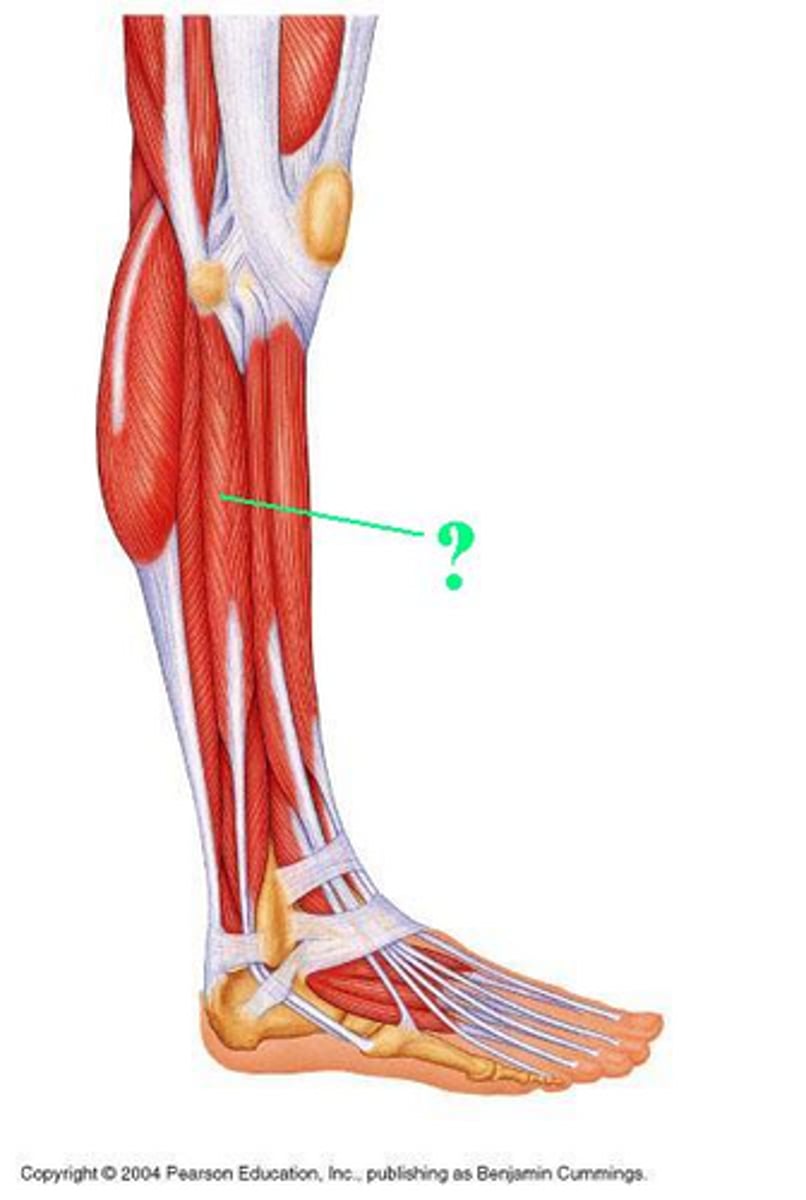 <p>Identify the indicated muscle</p>