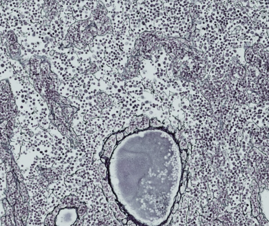 <p>Angiv farvning her for lymfeknuder</p>