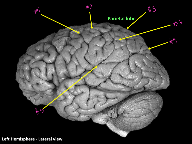 <p>What gyrus is #4</p>