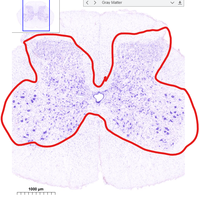 <p>(tissue type in circled area)</p>
