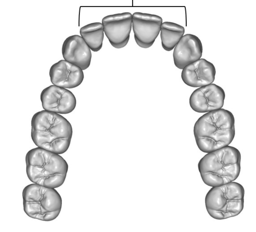 <p>What are the type of teeth the lines are pointing to </p>