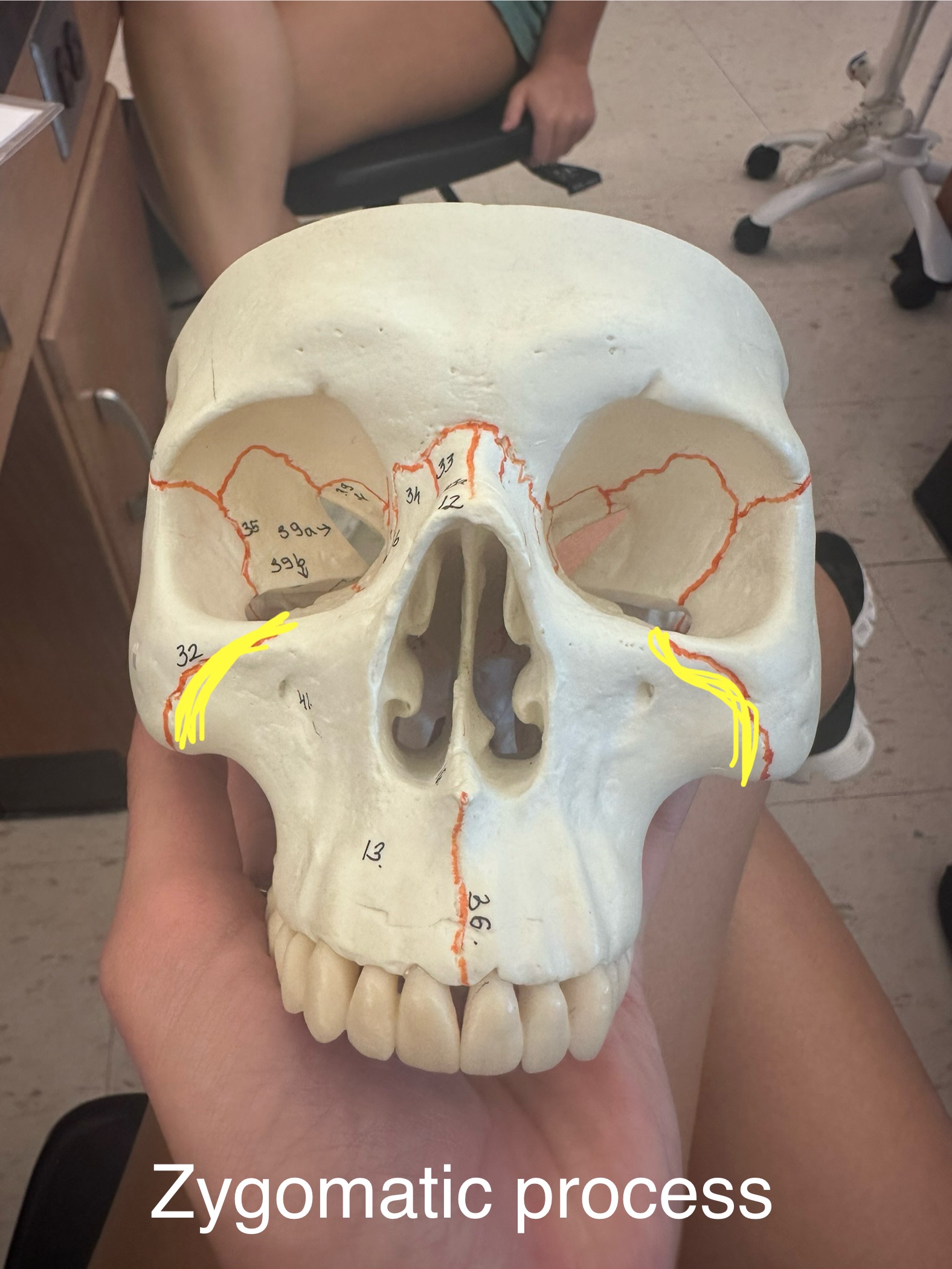 <p>Zygomatic Process</p>