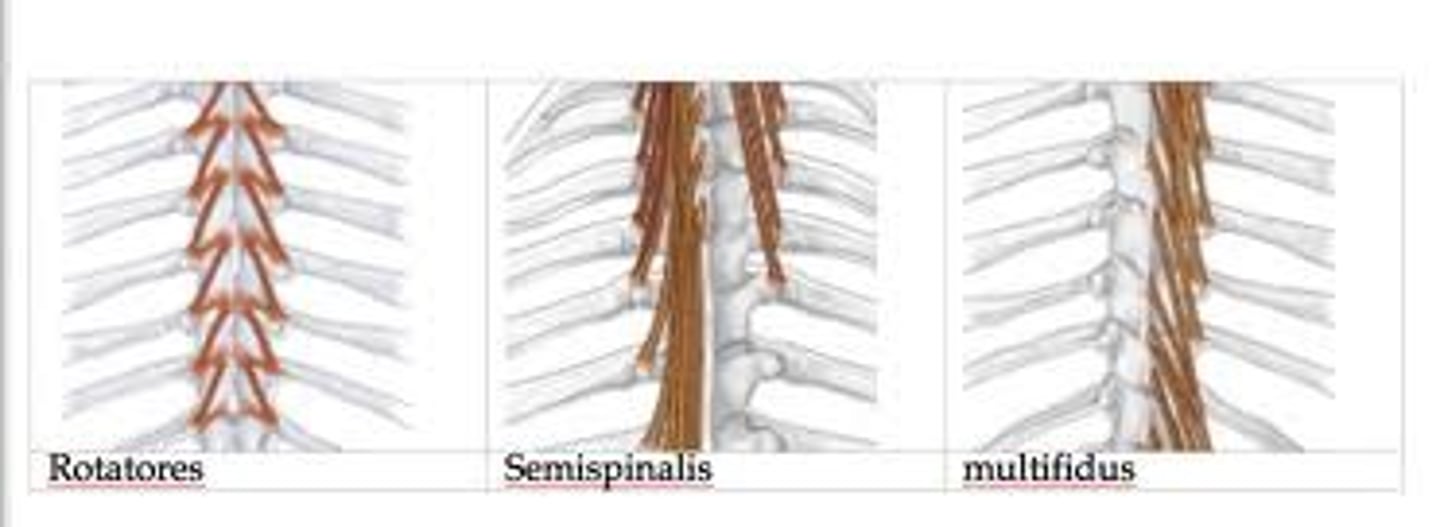 <p>semispinalis capitis, semispinalis cervicis, multifidus, rotatores are group of</p>