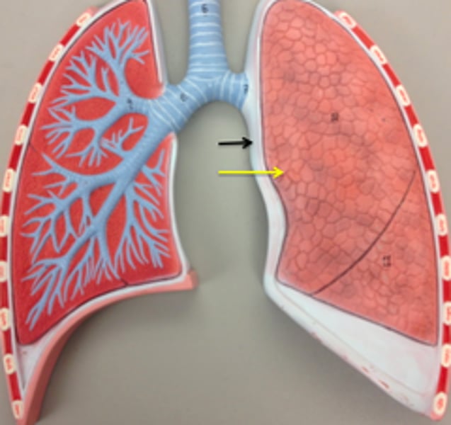 <p>The yellow arrow is pointing to what membrane?</p>