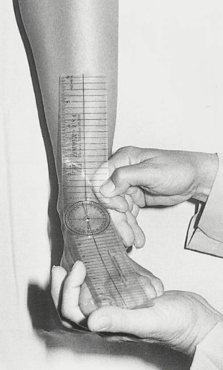 <p>Compare bilaterally</p>