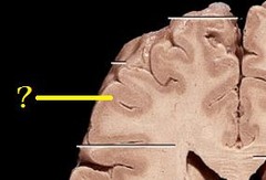 the outer, darker staining layer of the cerebrum
- made of gray matter