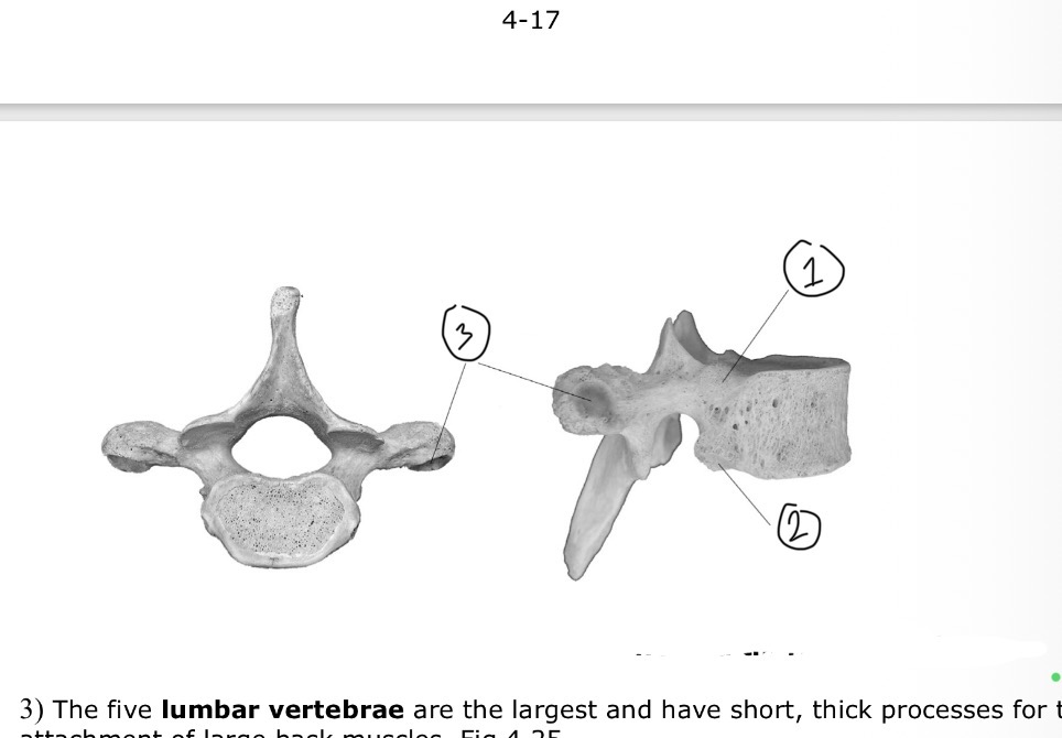 <p>Which vertebrae and its parts </p>