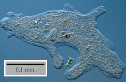 What is the organism that is depicted in the micrograph (note the scale bar)?