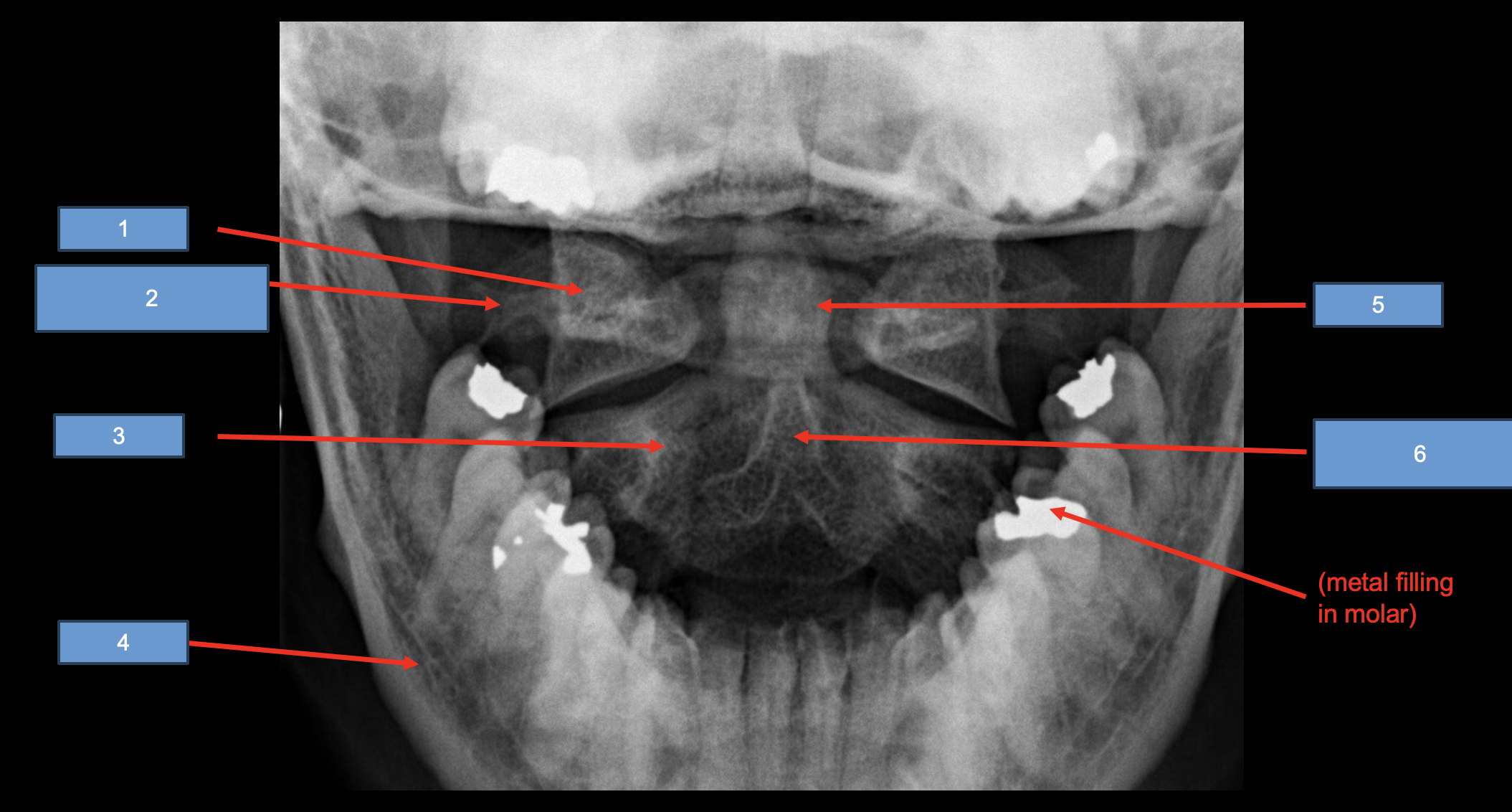<p>4</p>