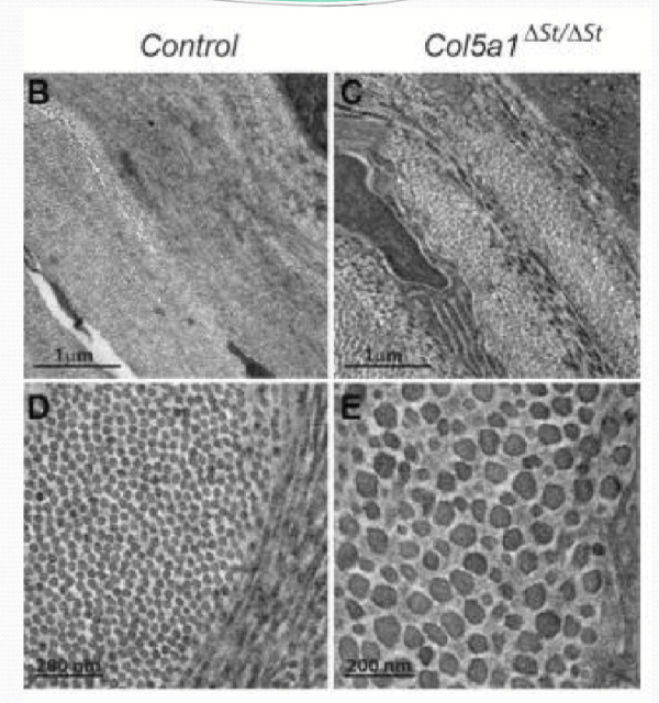 <p>It limits the diameter of collagen fibrils by introducing small mismatches in the alignment between type I and V collagen segments. It also prevents binding of additional segments due to weaker non-covalent bonds. </p>