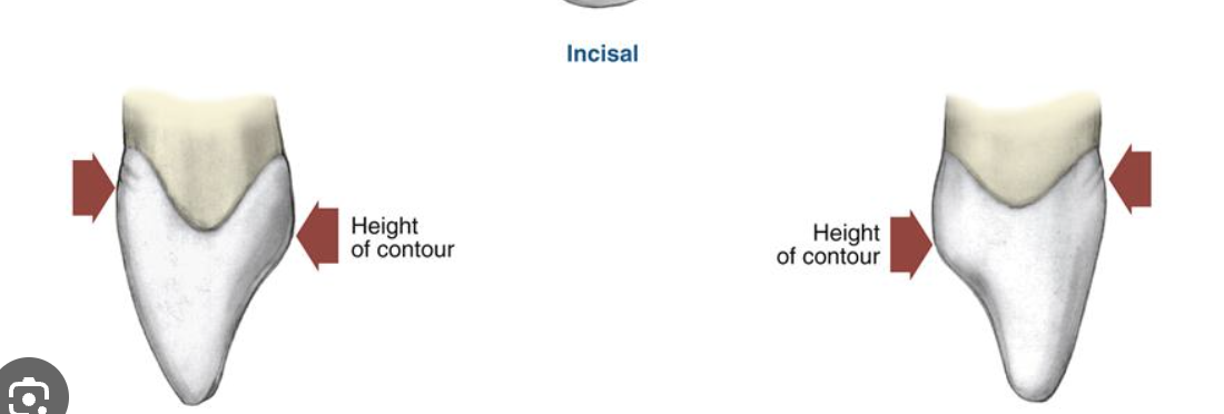 <p>NOT as deep or curved as mesial </p>
